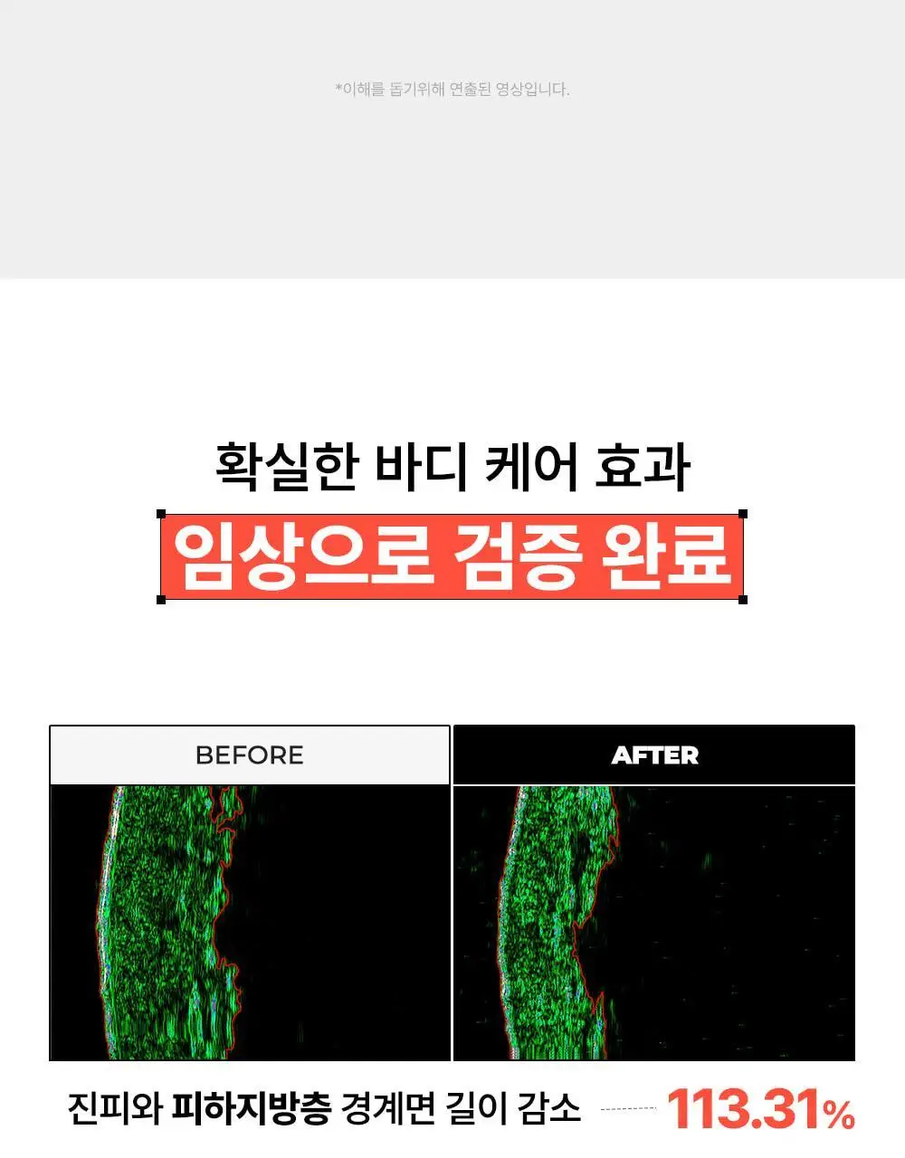 [NEW] 닥터빼 셀룰라이트 랩핑 패치 9g * 12ea 상세페이지 16
